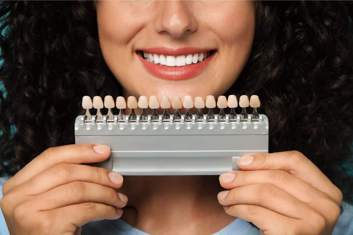 Can Veneers Be Taken Off