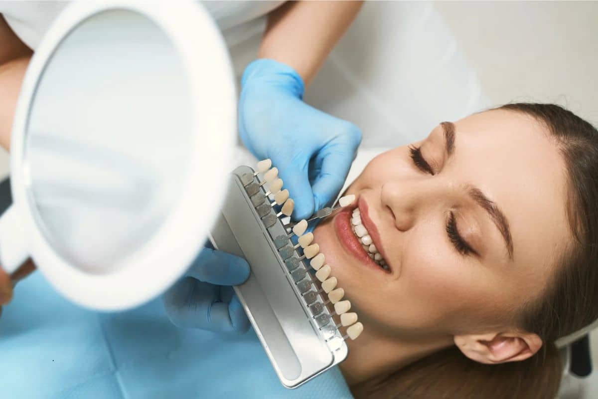 How Long Do Veneers Last