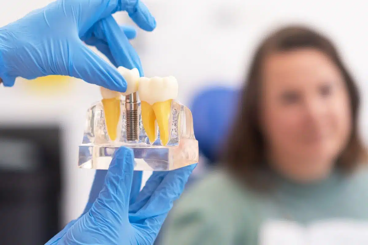 No Dairy After Dental Implants