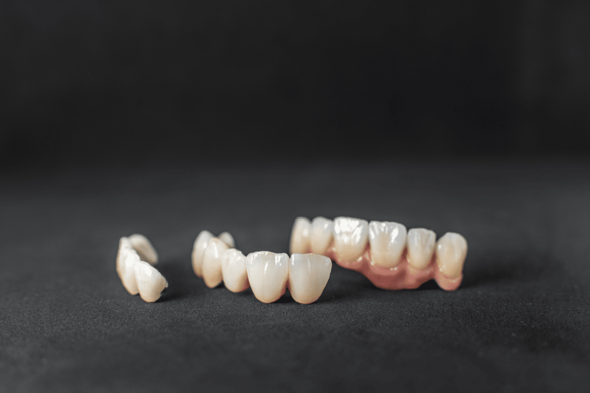 dental bridges in Cheshire