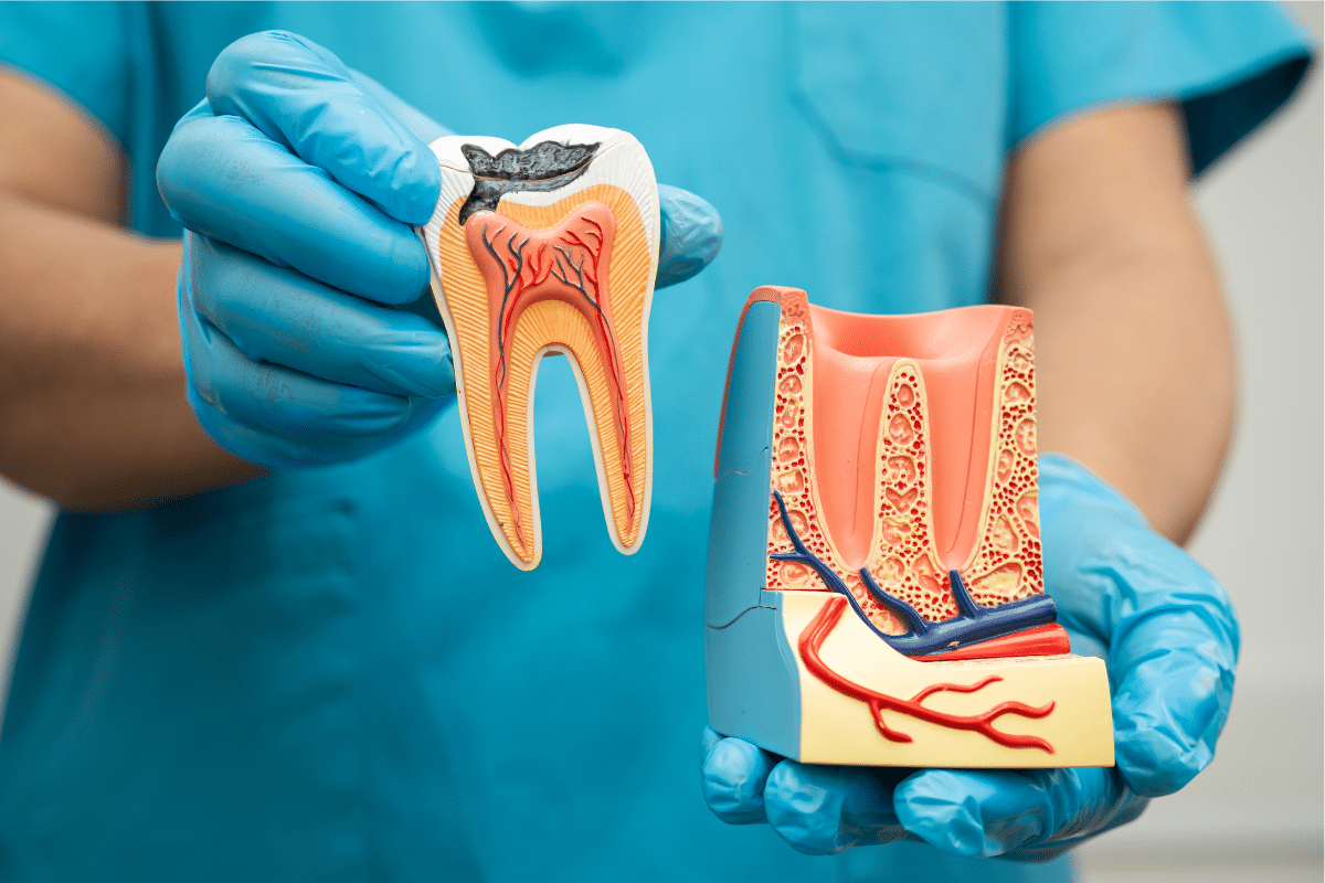 dental fillings in Cheshire