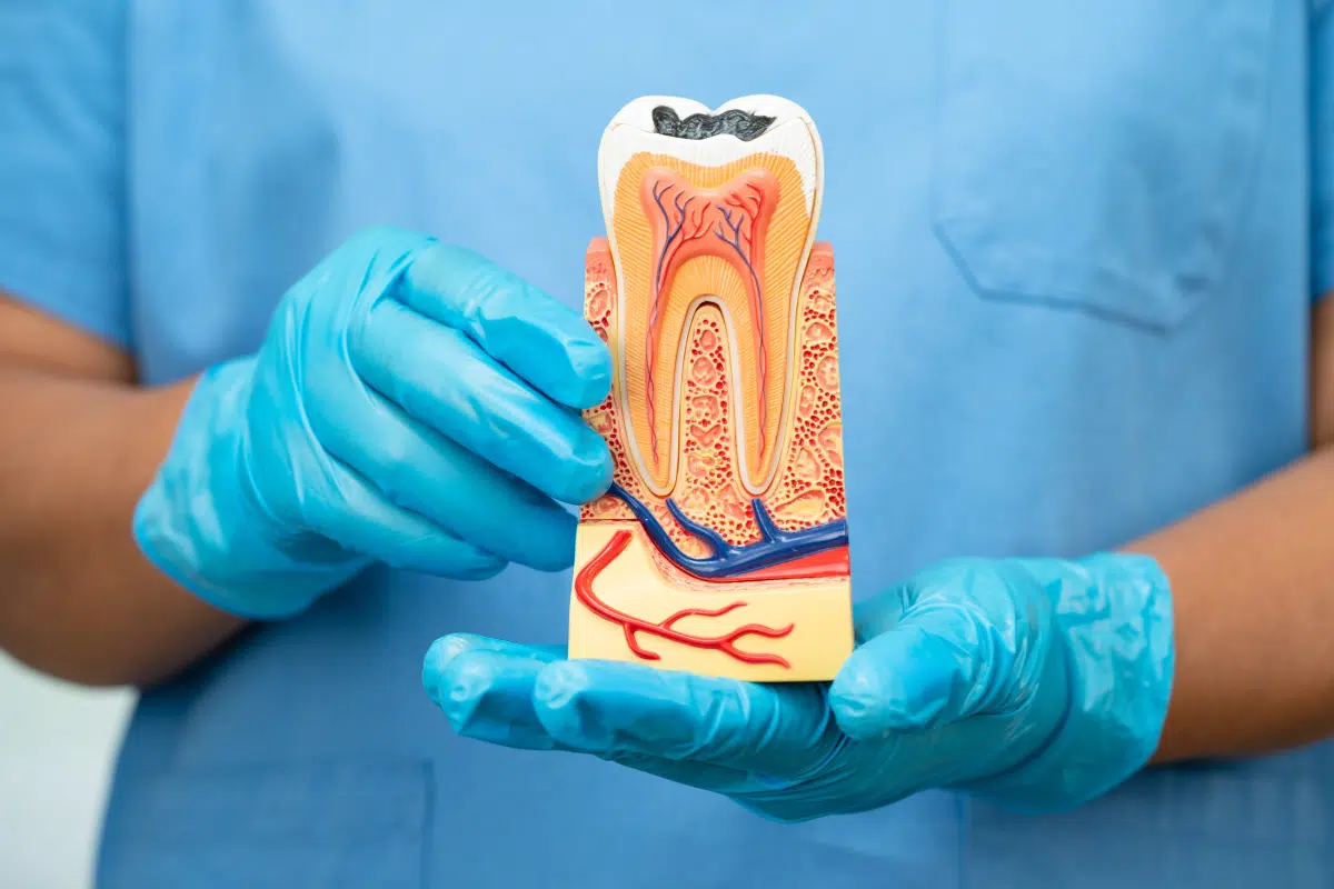 Dental Implants in Cheshire
