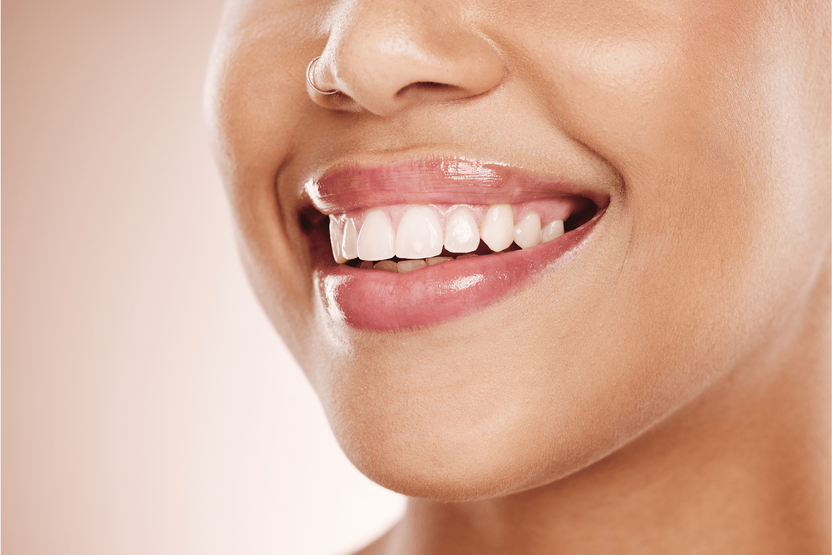 Teeth Whitening Cheshire